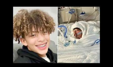 TikTok trend went wrong, causing a 16-year-old boy to suffer third-degree burns