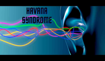 Havana syndrome- Why do we care?