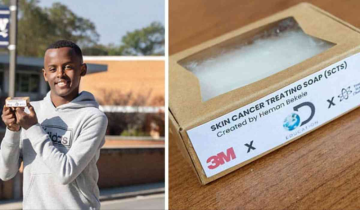 US Teen Develops Soap For Skin Cancer Treatment That Costs Less Than $10....