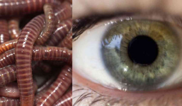 60 live worms found in woman's eyes in China