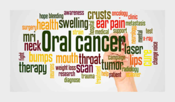 Oral Cancer Task Force's Consensus Guidelines for Head & Neck Cancer Recognized Among 13 Worldwide Clinical Practice Guidelines