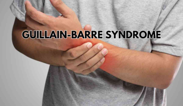 Guillain-Barre Syndrome: First suspected death in Maharashtra, cases in Pune reach 101