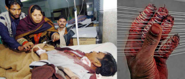 Deadly Chinese Manjha Claims Lives Again Despite Ban