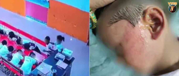 5-Year-Old Nursery Student Allegedly Beaten for 12 Minutes by Class Monitor in Lucknow; CCTV Video Goes Viral