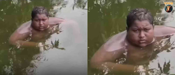 The Boy Who Lives in Water: 16-Year-Old's Rare Condition Baffles India