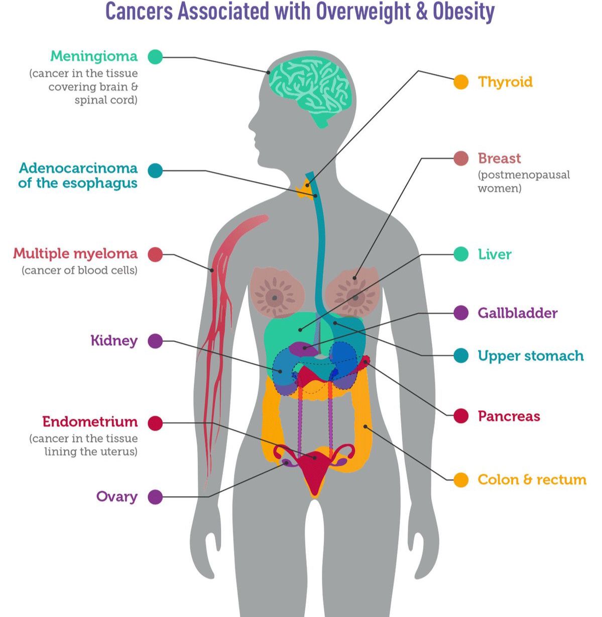 cancer related to obesity