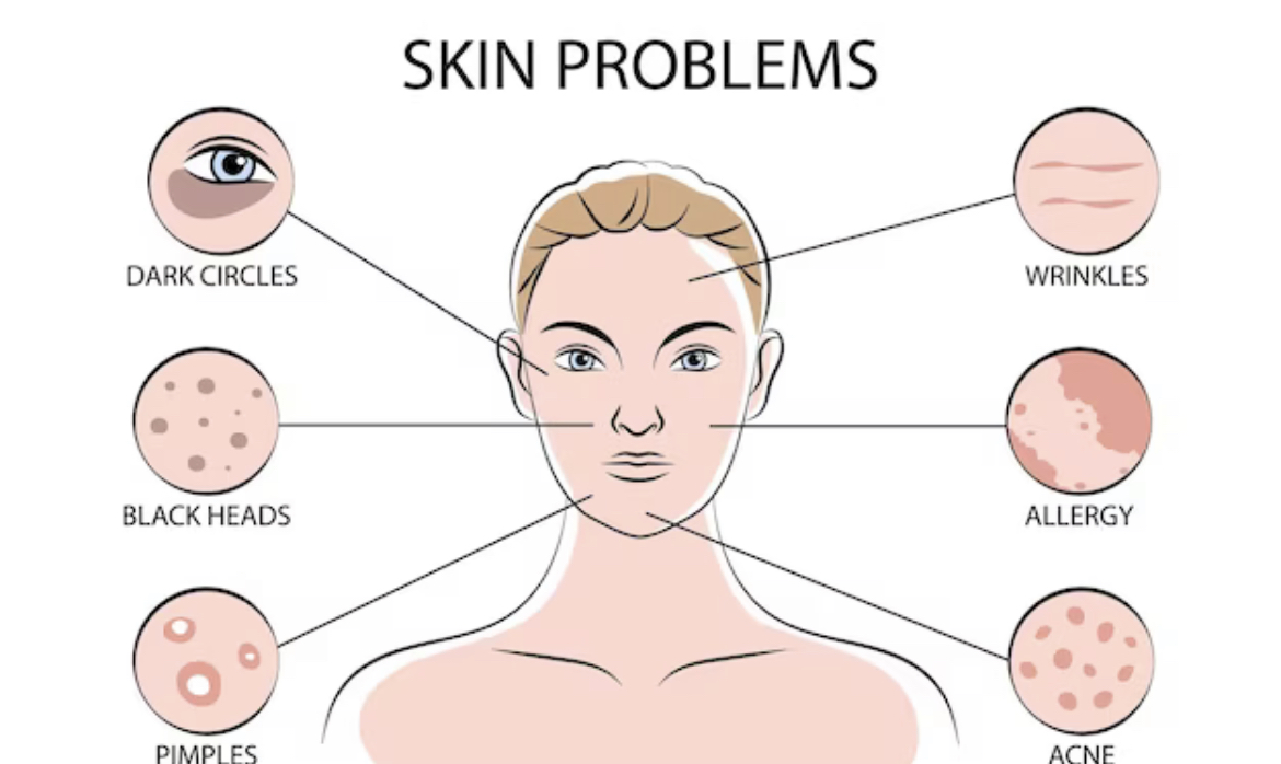 Photo Repeated Skin Problems