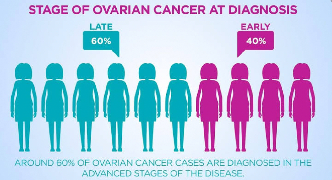 Rising Ovarian Cancer Cases in India Linked to Late Detection