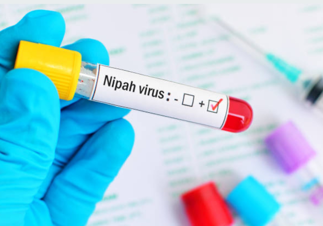 Photo: Nipah Virus