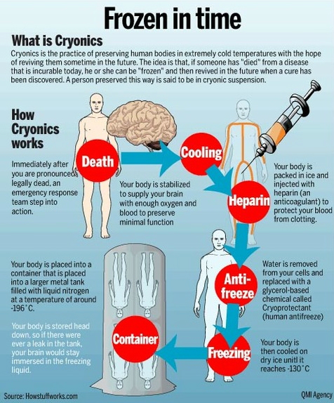 photo : cryonics