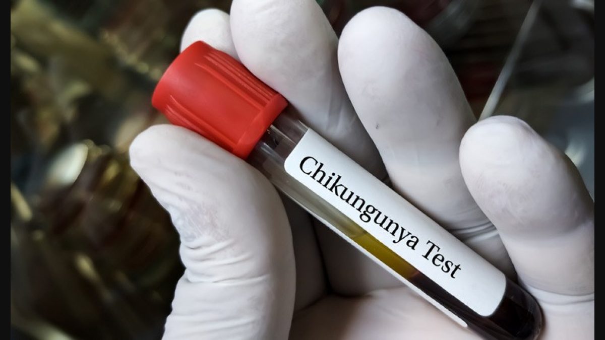 Photo: US approves first vaccine against Chikungunya virus