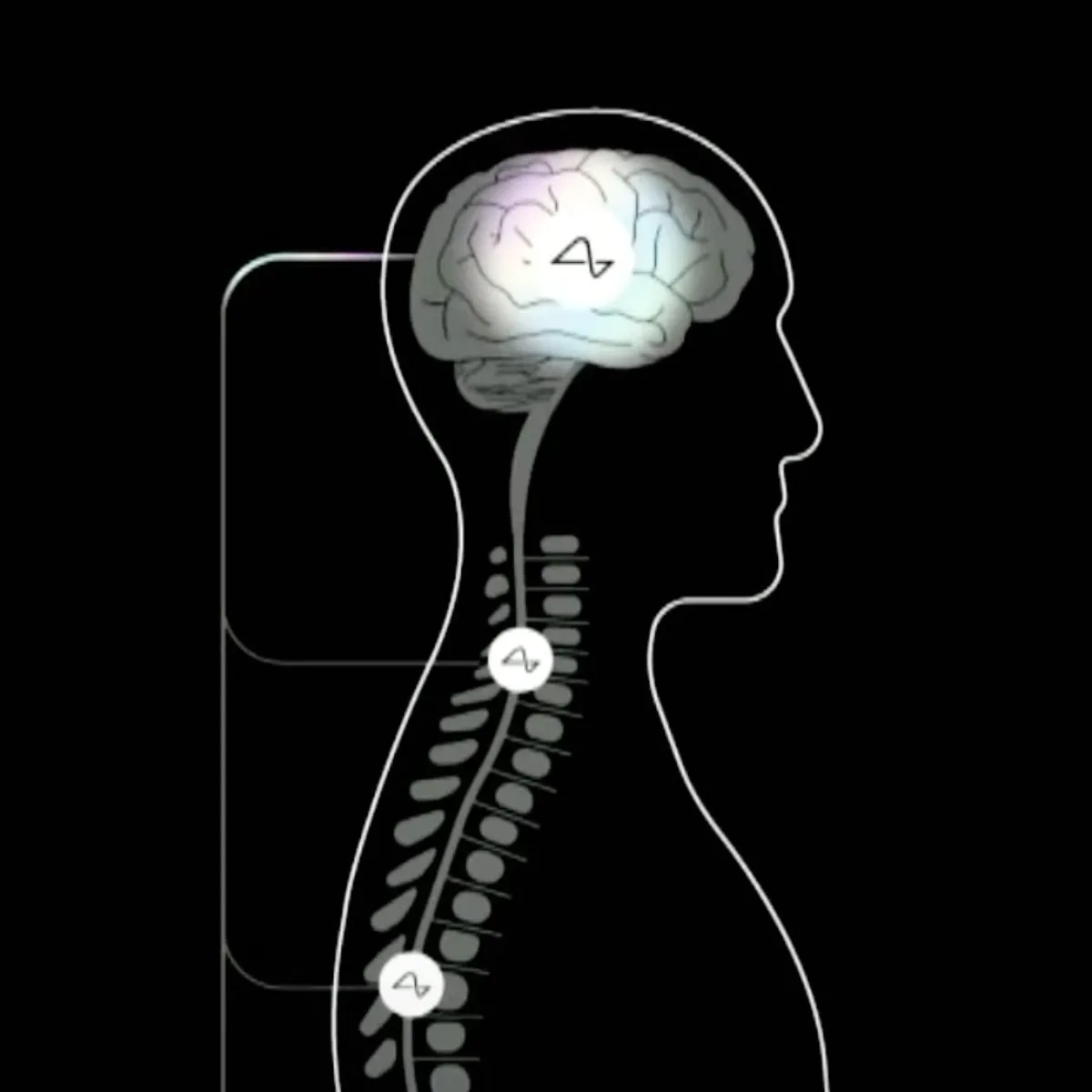 Neuralink brain chip, that will regain motor function is a paralyzed patient 