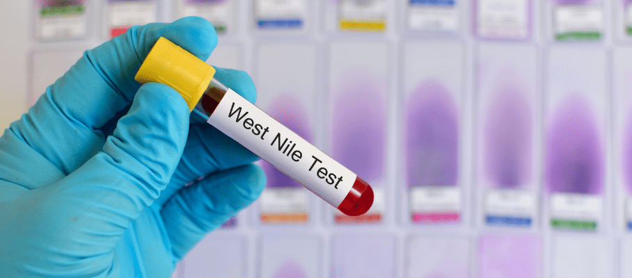 west nile fever